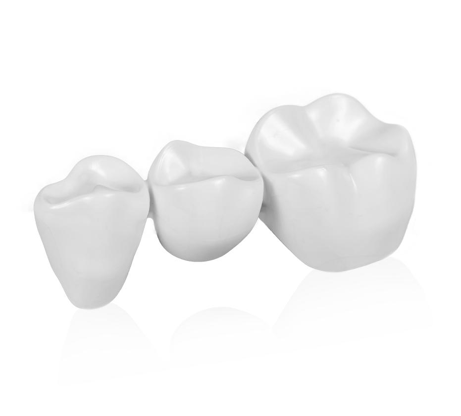 dental-bridge.png