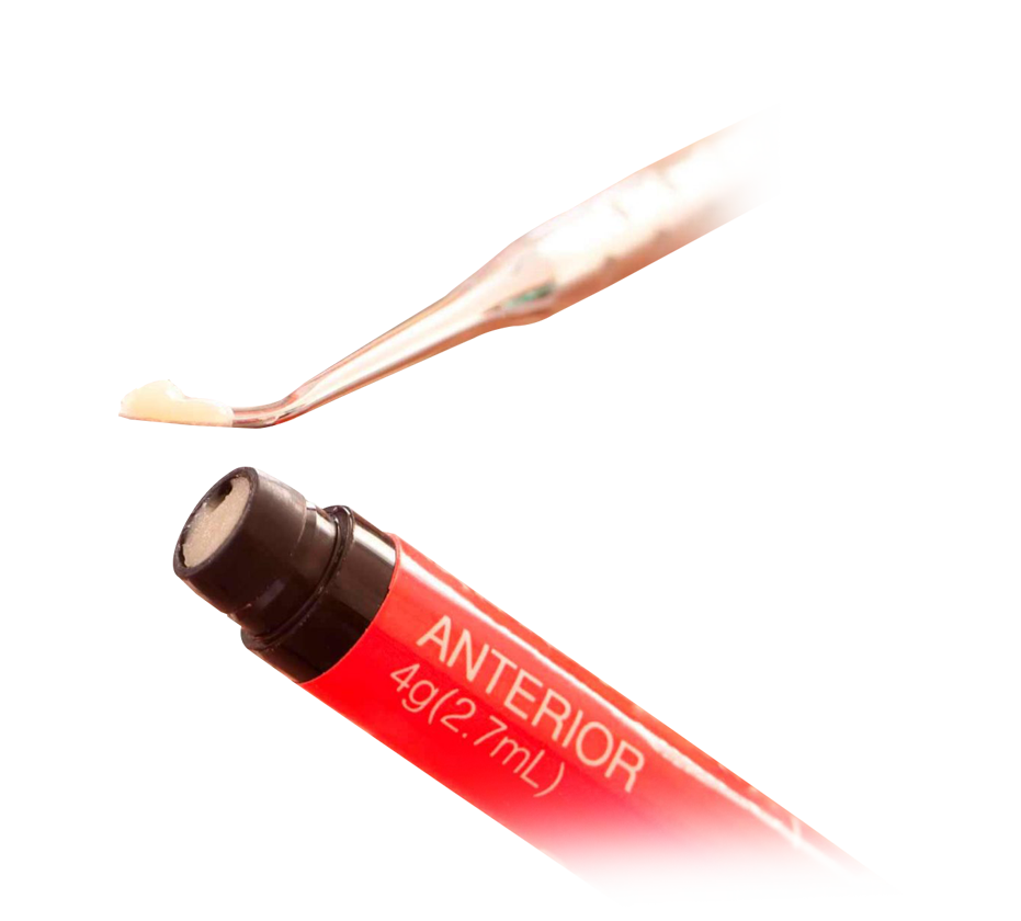 composite-filling.png