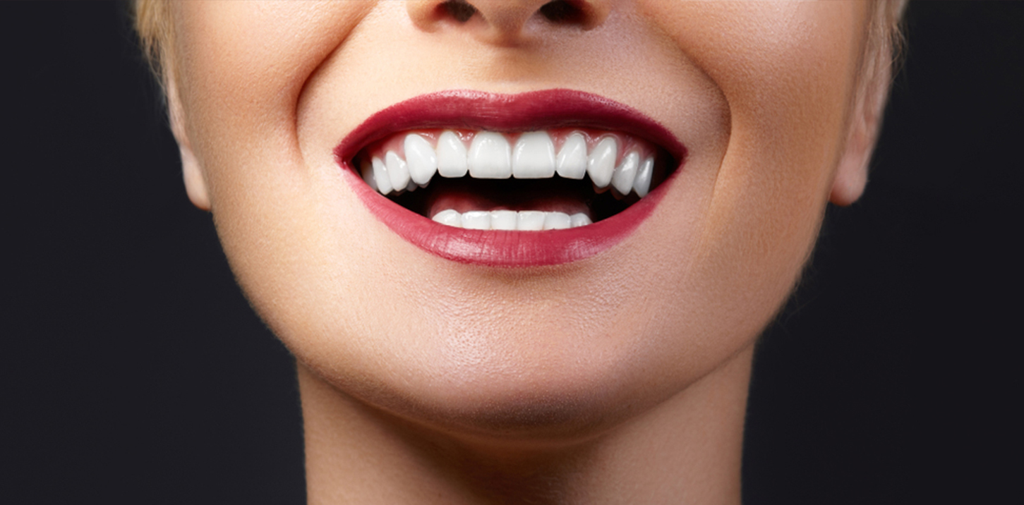 glass-ceramic-crowns-dentistkusadasi-2
