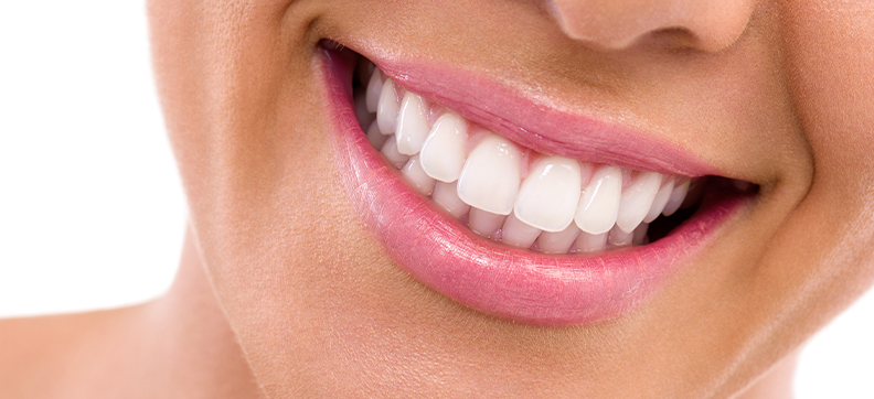 laminate-veneers-dentistkusadasi-2021-3_1