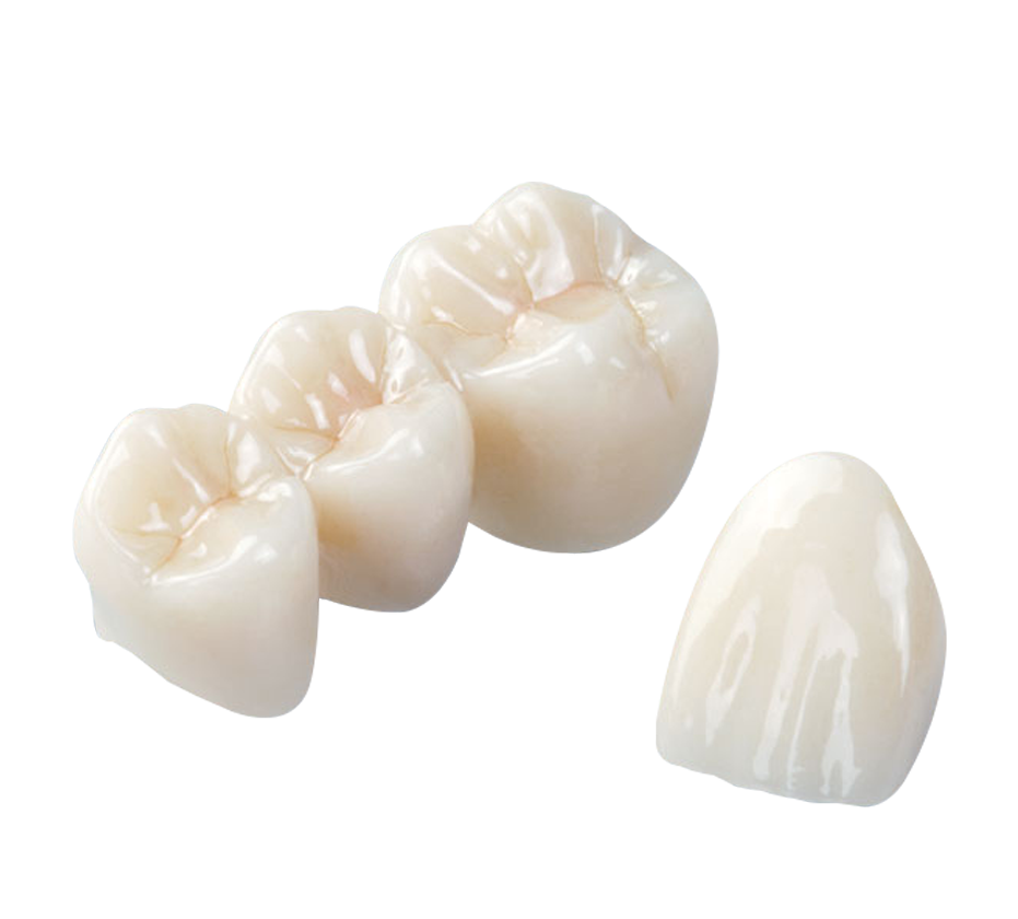 porcelain-crowns.png