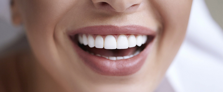 zirconium-crown-dentist-kusadasi-1